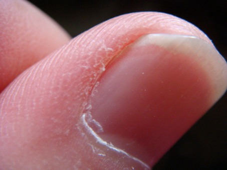 Skórki wokół paznokci: wycinać czy odsuwać?