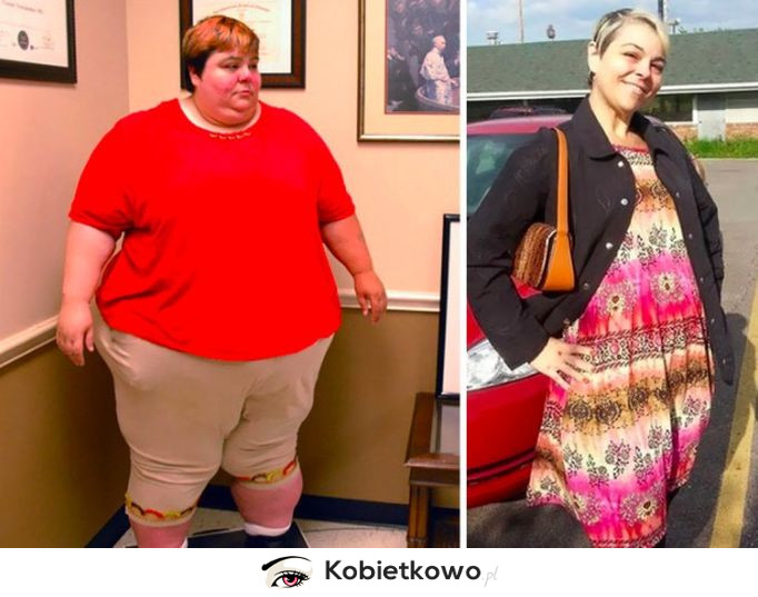 Jak wygląda drastyczna zmiana? Te kobiety zrobiły to- zrzuciły ogromną liczbę kilogramów!