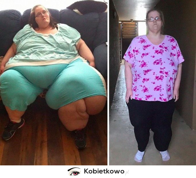 Jak wygląda drastyczna zmiana? Te kobiety zrobiły to- zrzuciły ogromną liczbę kilogramów!