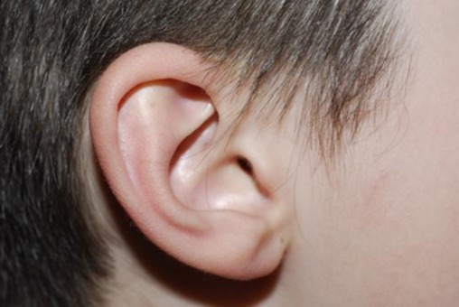 Używanie patyczków do czyszczenia uszu może mieć TRAGICZNE konsekwencje! KONIECZNA MOŻE BYĆ OPERACJA!