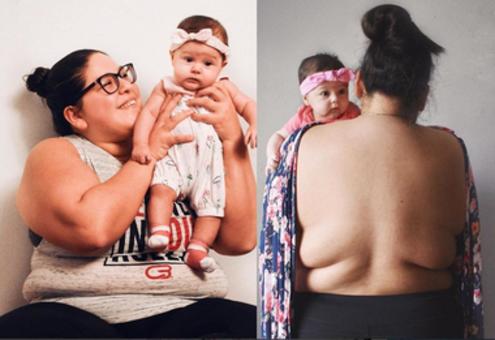 Matka z Teksasu pokazuje ciało po ciąży, w której przytyła prawie 30 kg!